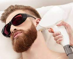 laser hair removal
