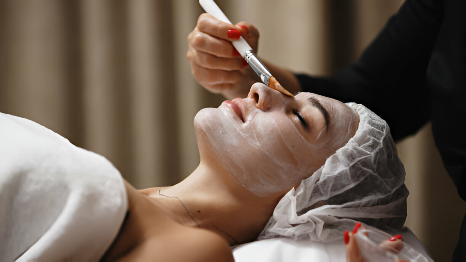 Chemical Peel