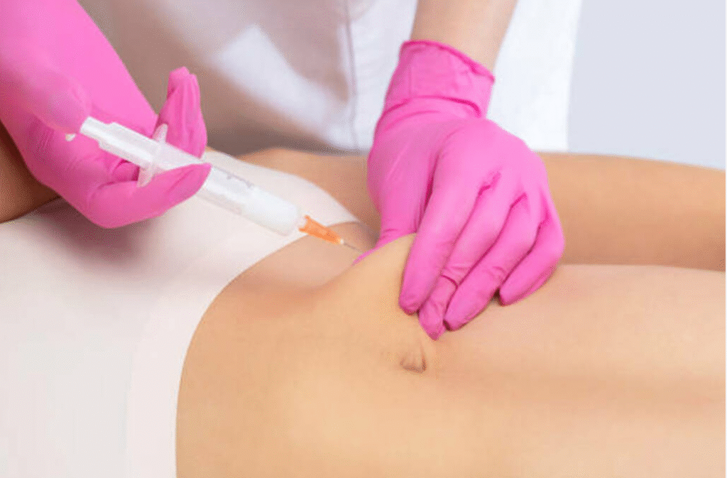 Fat Lipolysis Injections